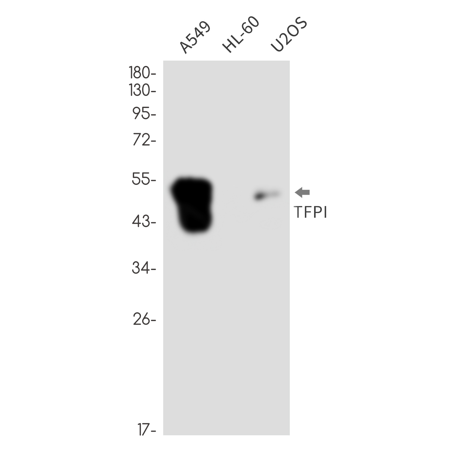 Tissue Factor Pathway Inhibitor Rabbit mAb ABZ3371