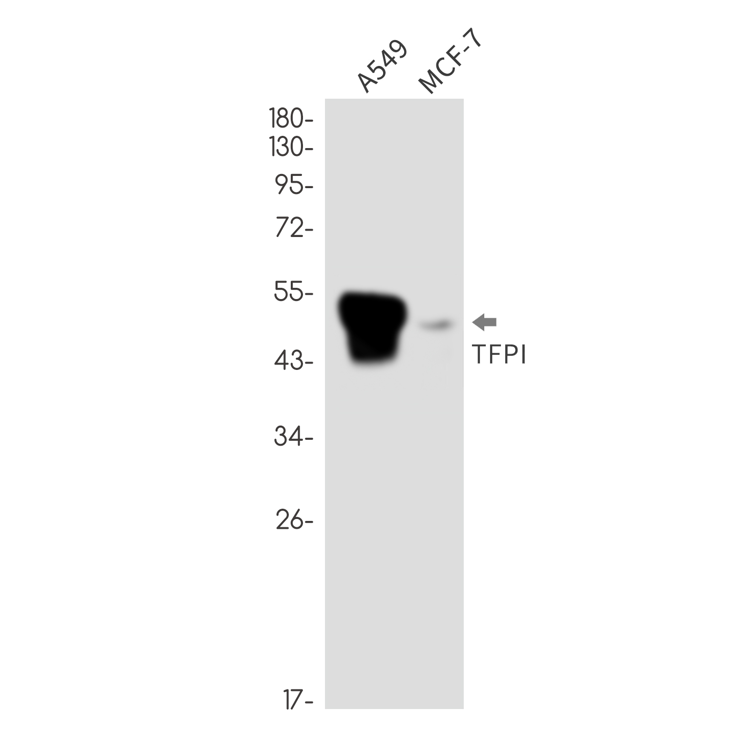 Tissue Factor Pathway Inhibitor Rabbit mAb ABZ3372