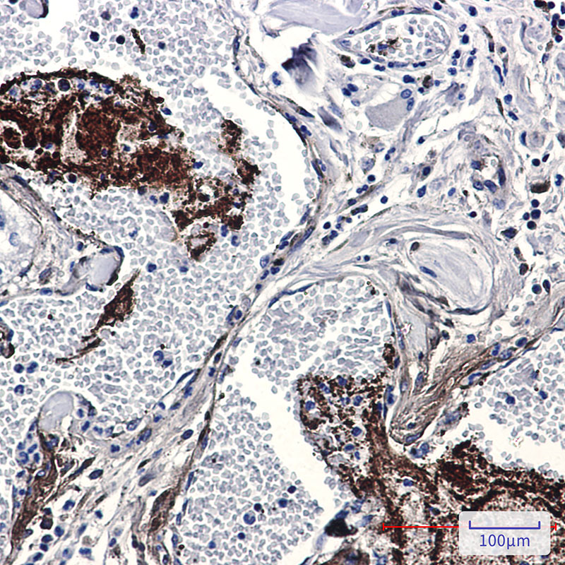 Thrombospondin 1 Rabbit mAb ABZ3373
