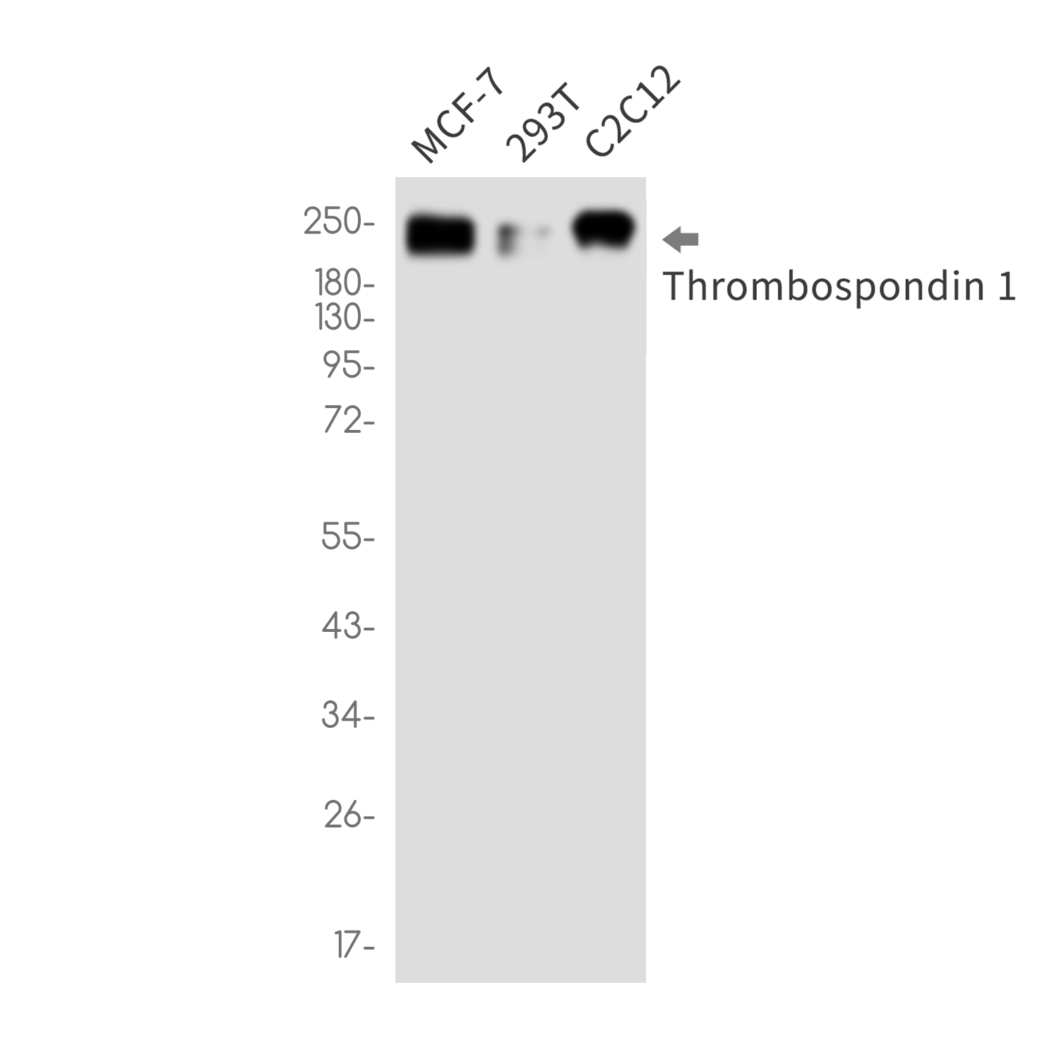 Thrombospondin 1 Rabbit mAb ABZ3373