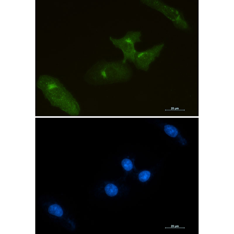 Tissue Factor Rabbit mAb ABZ3374