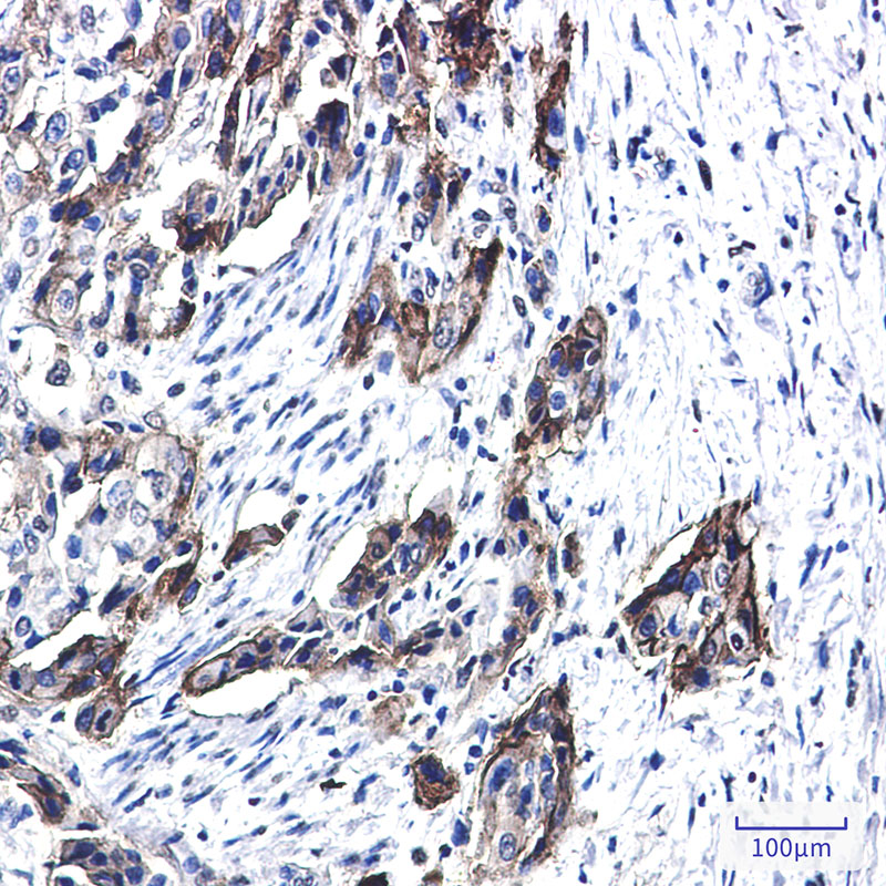 Tissue Factor Rabbit mAb ABZ3374