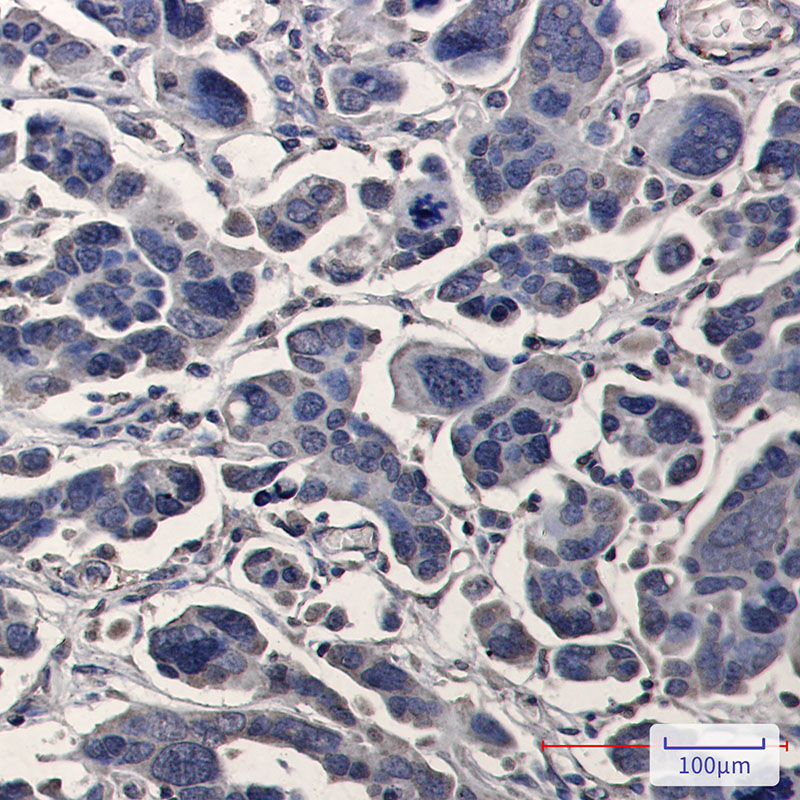 TPMT Rabbit mAb ABZ3375