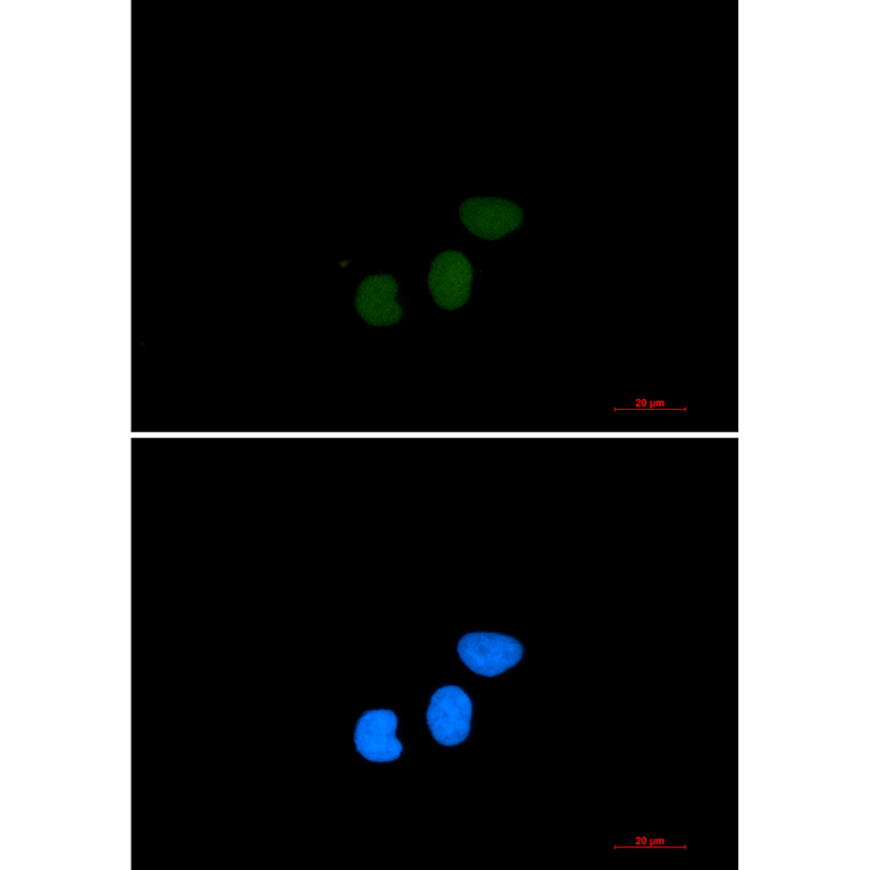 TPX2 Rabbit mAb ABZ3376