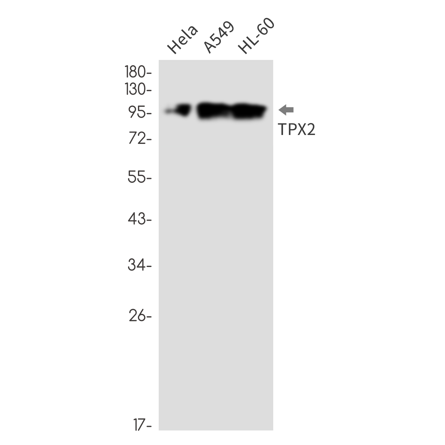 TPX2 Rabbit mAb ABZ3376