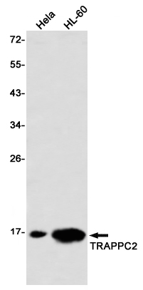 TRAPPC2 Rabbit mAb ABZ3377
