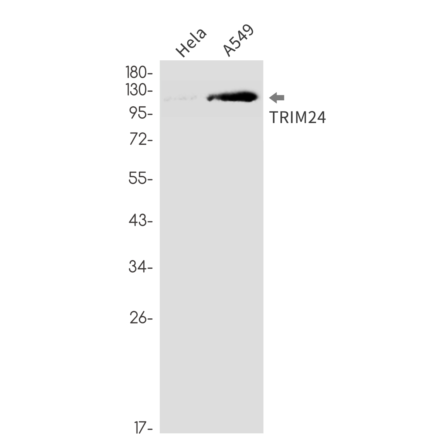 TRIM24 Rabbit mAb ABZ3378