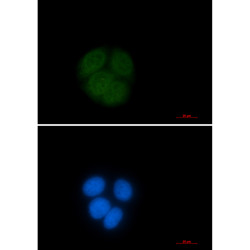 Ubiquitin Conjugating Enzyme E2 C Rabbit mAb ABZ3379