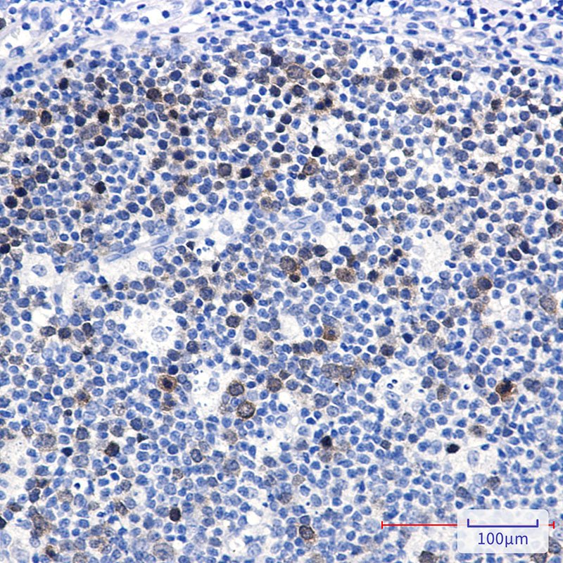 Ubiquitin Conjugating Enzyme E2 C Rabbit mAb ABZ3379