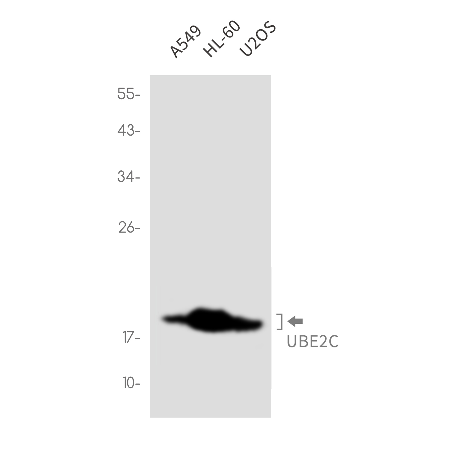 Ubiquitin Conjugating Enzyme E2 C Rabbit mAb ABZ3379