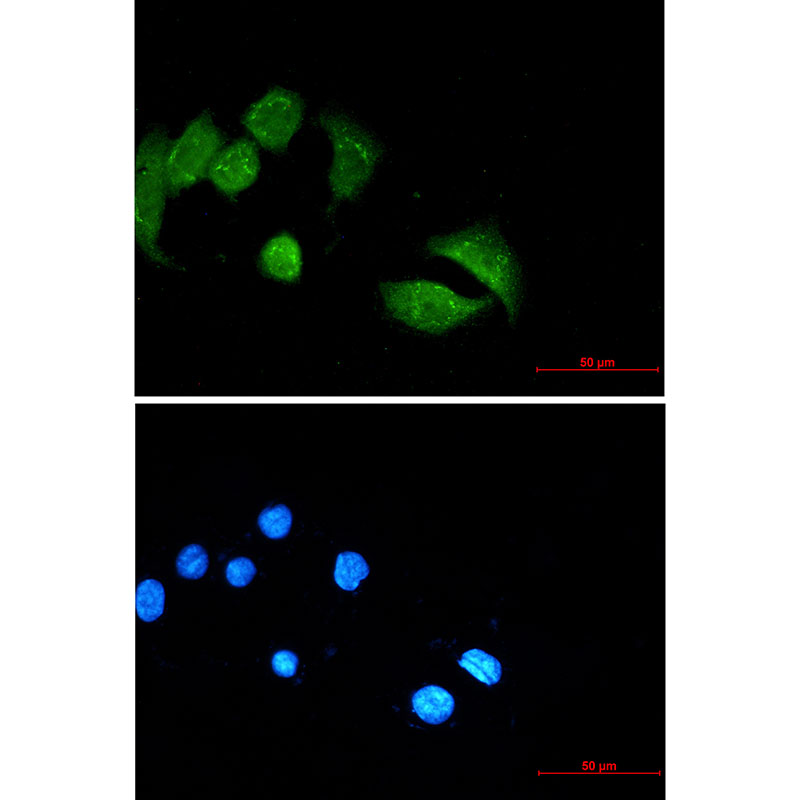 Ubiquitin Conjugation Factor E4 B Rabbit mAb ABZ3380