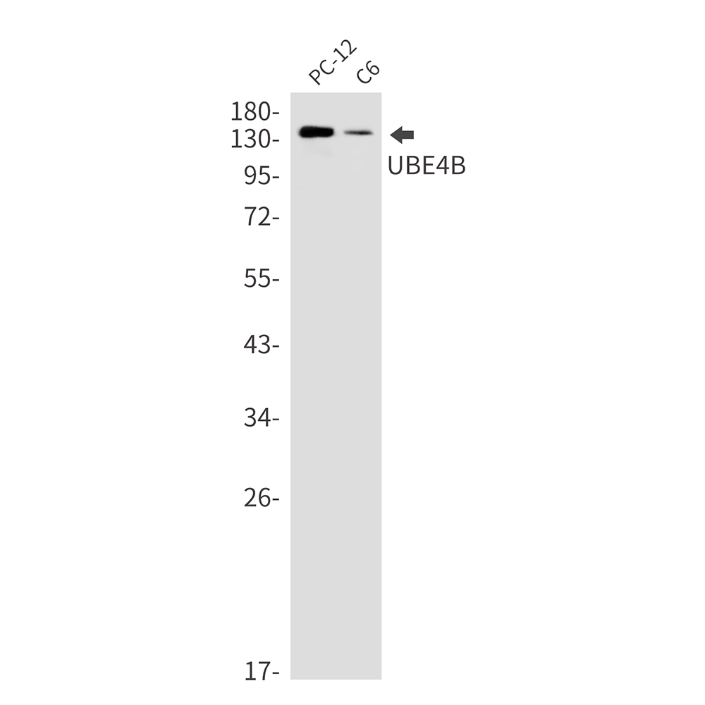 Ubiquitin Conjugation Factor E4 B Rabbit mAb ABZ3380