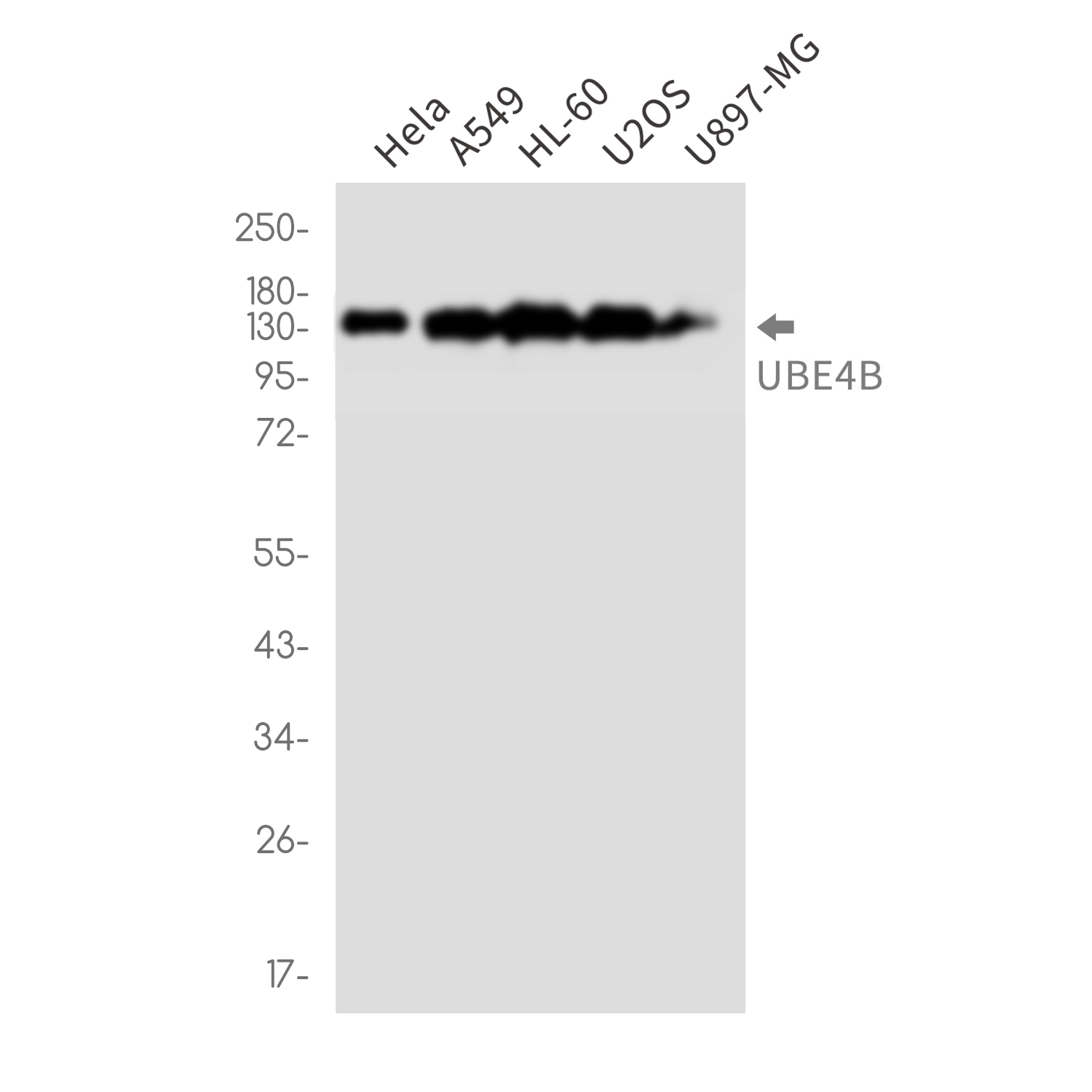 Ubiquitin Conjugation Factor E4 B Rabbit mAb ABZ3380