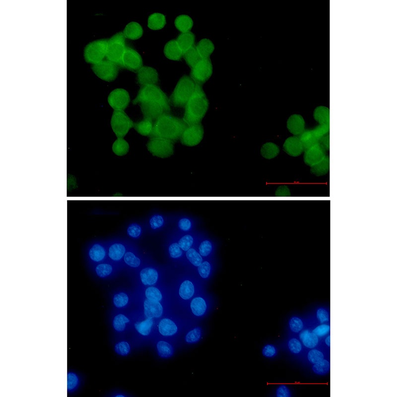 Ubiquitin K63 Rabbit mAb ABZ3381