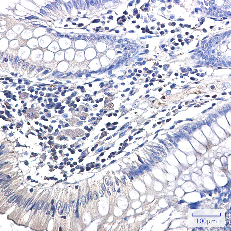 Ubiquitin K63 Rabbit mAb ABZ3381