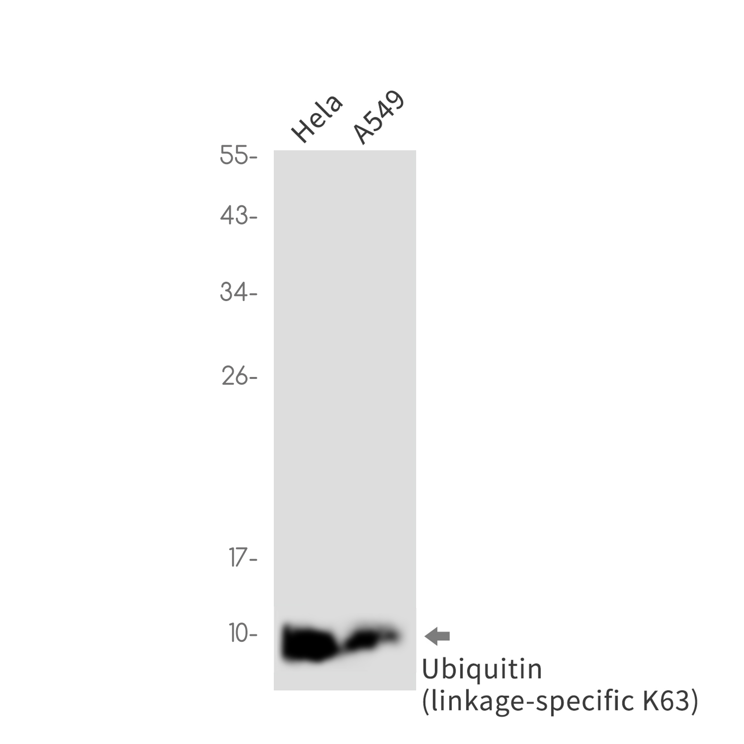 Ubiquitin K63 Rabbit mAb ABZ3381