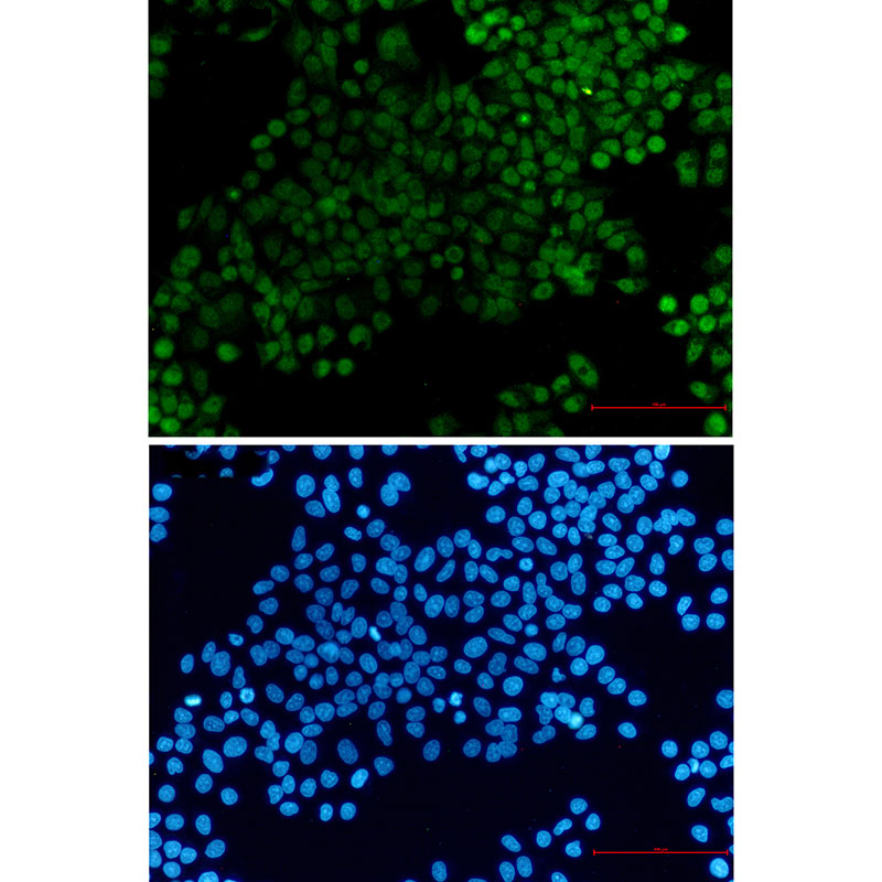 XRCC1 Rabbit mAb ABZ3383