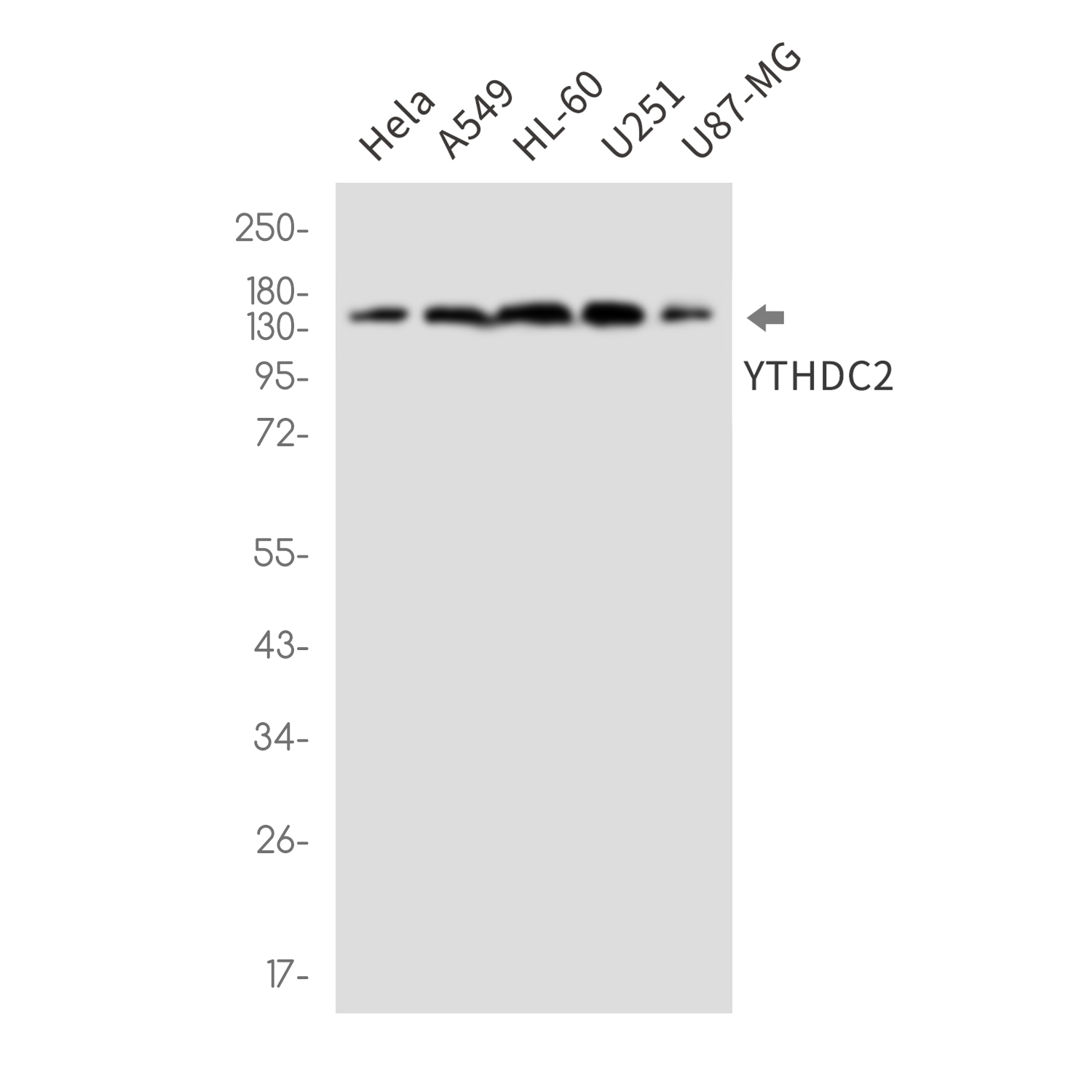 YTHDC2 Rabbit mAb ABZ3384
