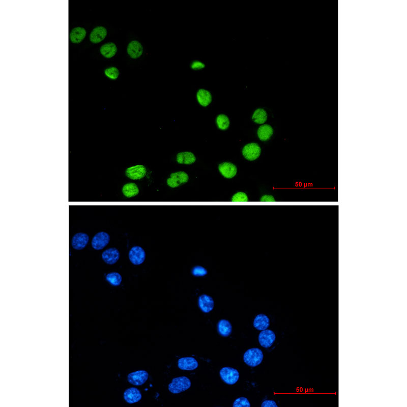 ZBTB7A Rabbit mAb ABZ3385