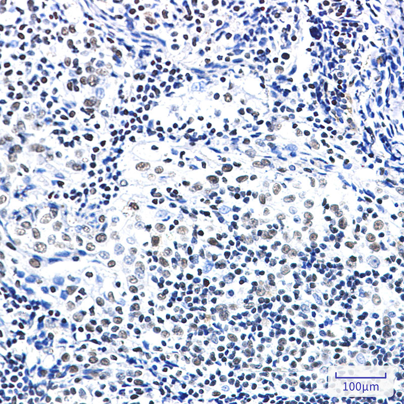 ZBTB7A Rabbit mAb ABZ3385
