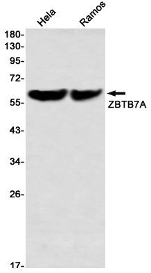 ZBTB7A Rabbit mAb ABZ3385