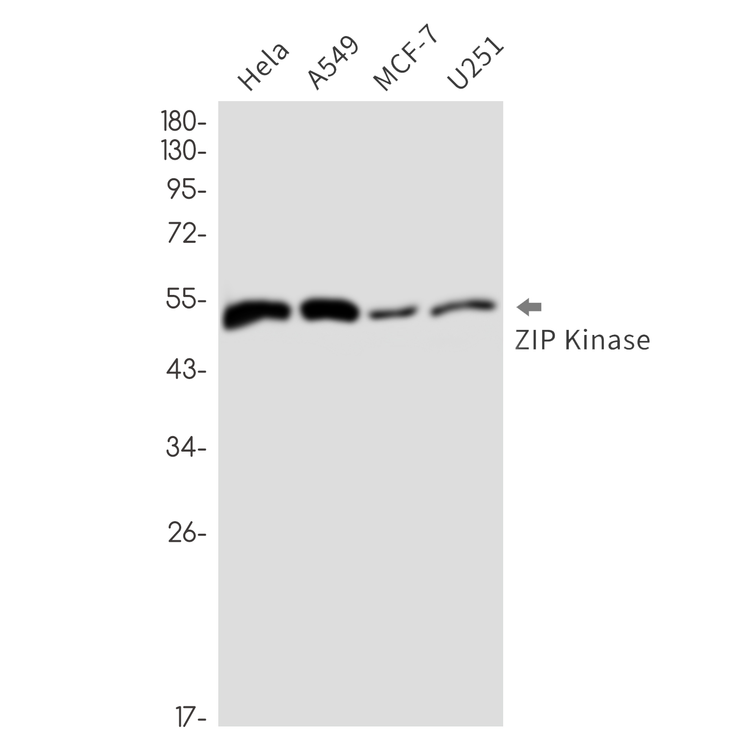 DAPK3 Rabbit mAb ABZ3386