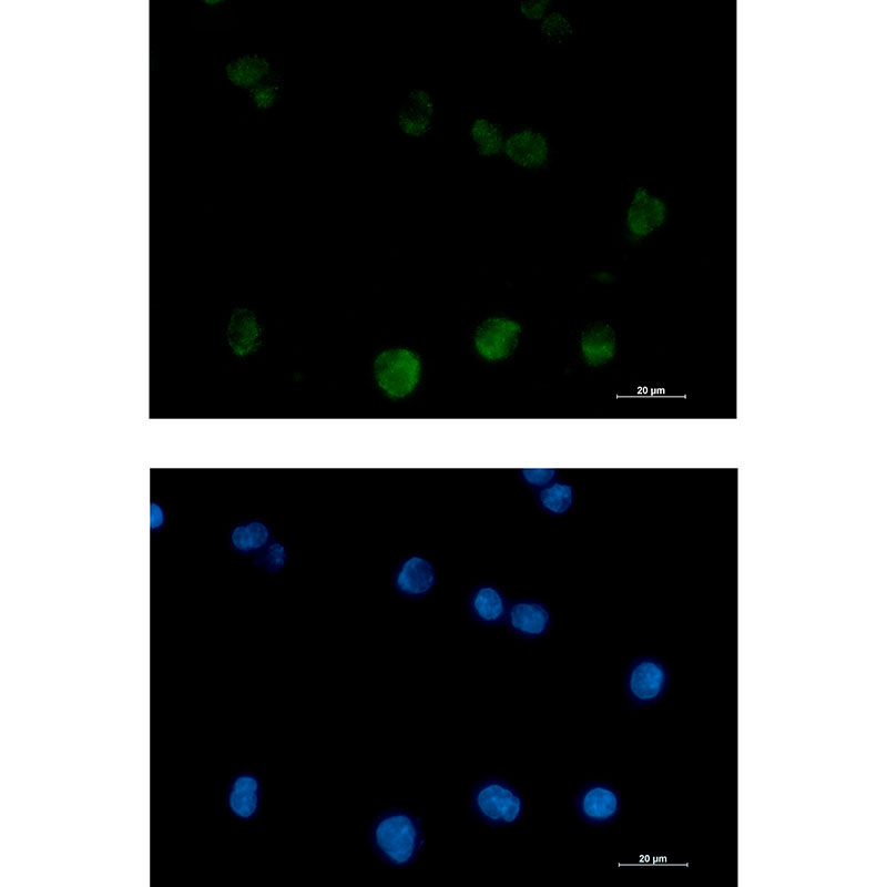 PKC beta 2 Rabbit mAb ABZ3387