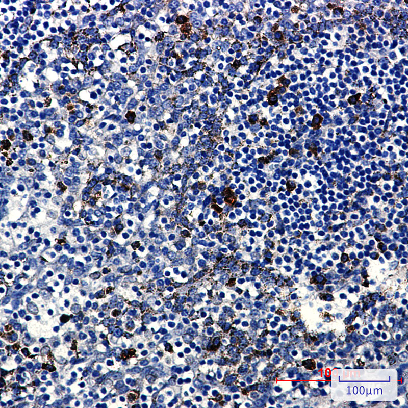PKC beta 2 Rabbit mAb ABZ3387