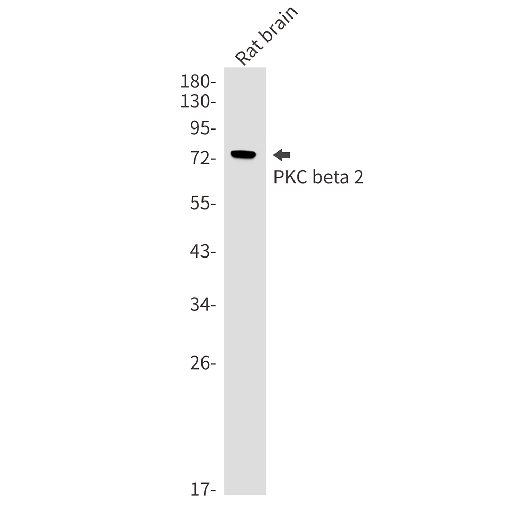 PKC beta 2 Rabbit mAb ABZ3387