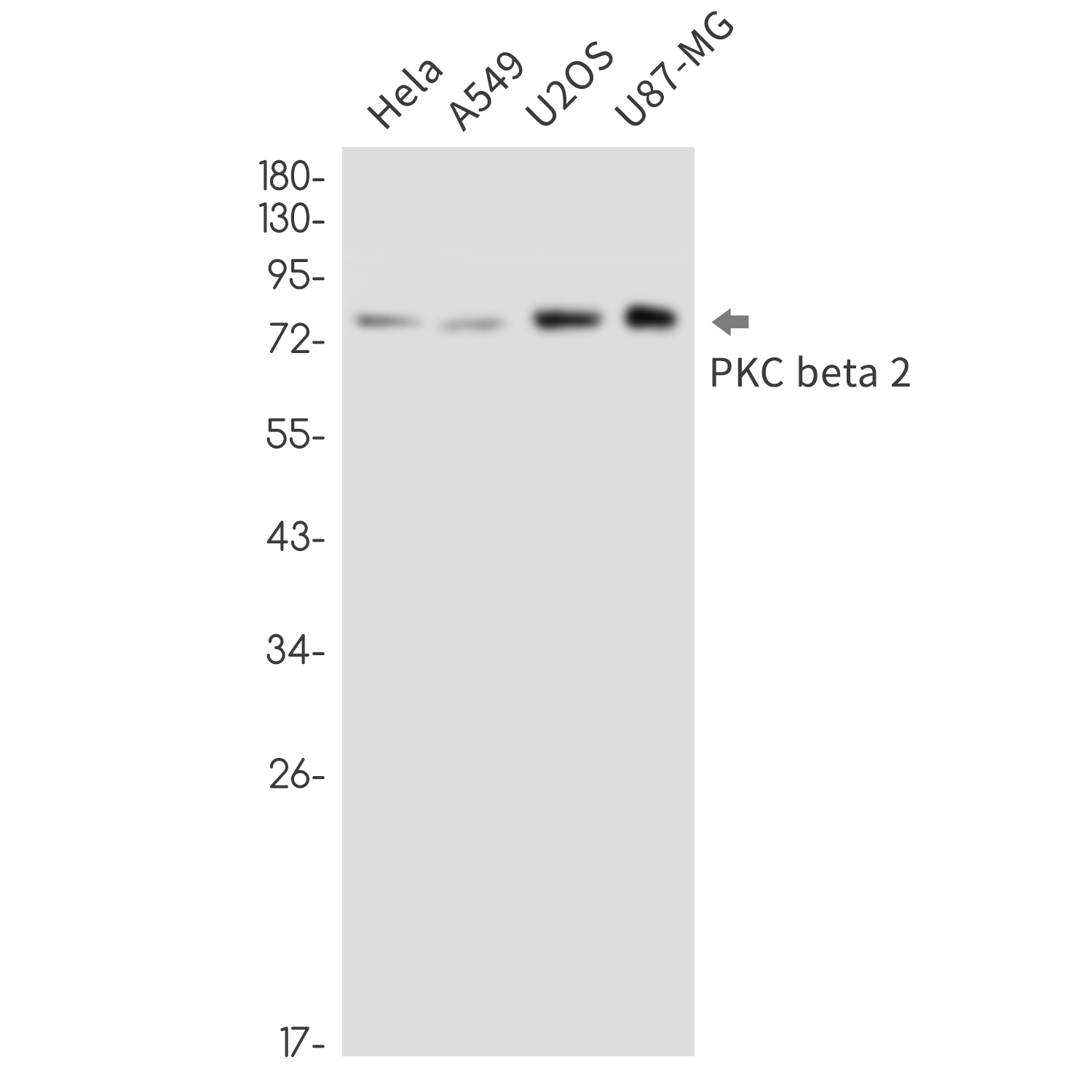 PKC beta 2 Rabbit mAb ABZ3387