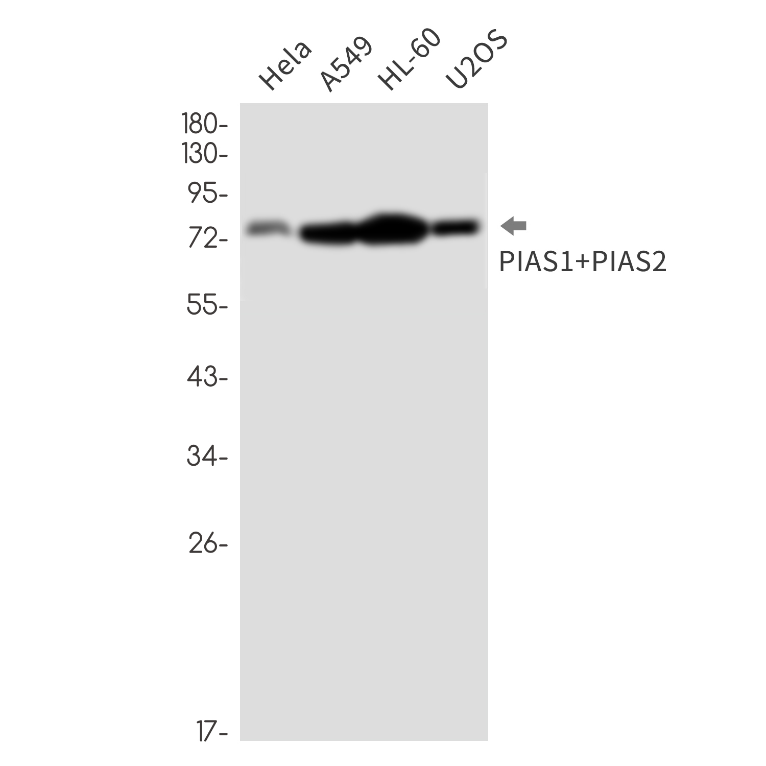 PIAS1/2 Rabbit mAb ABZ3388