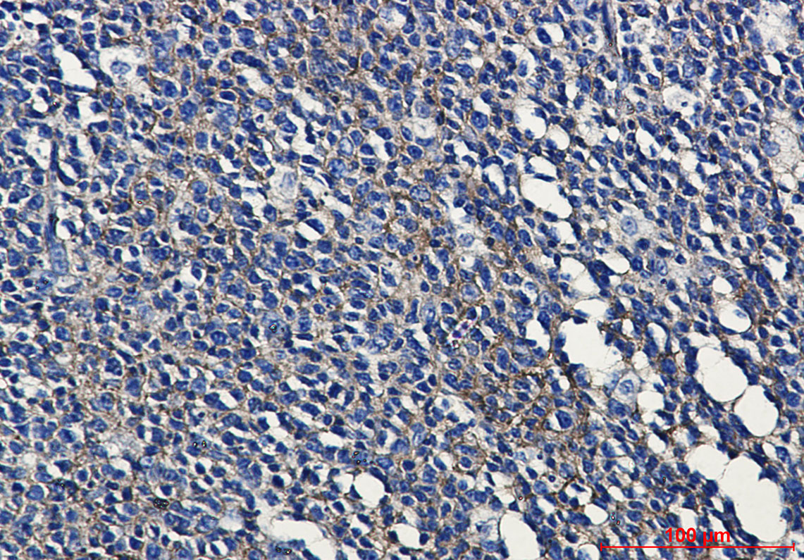 HLA A Rabbit mAb ABZ3389