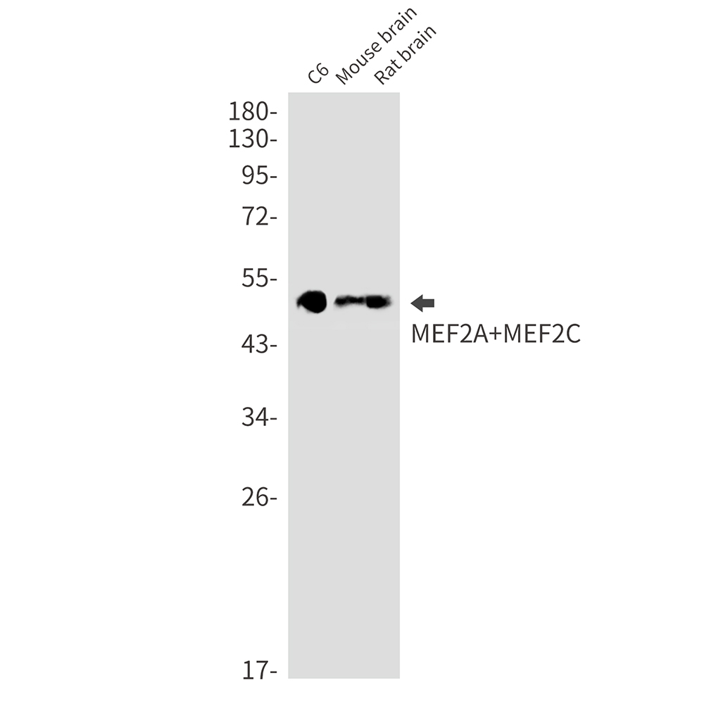 MEF2A/MEF2C Rabbit mAb ABZ3390