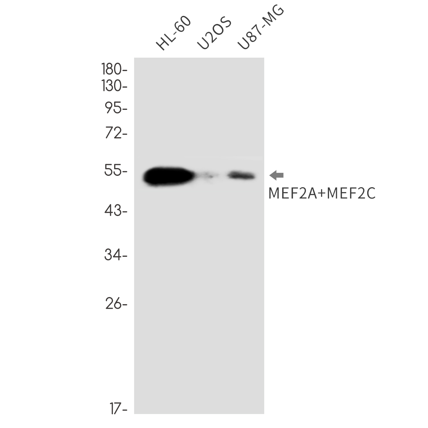 MEF2A/MEF2C Rabbit mAb ABZ3390