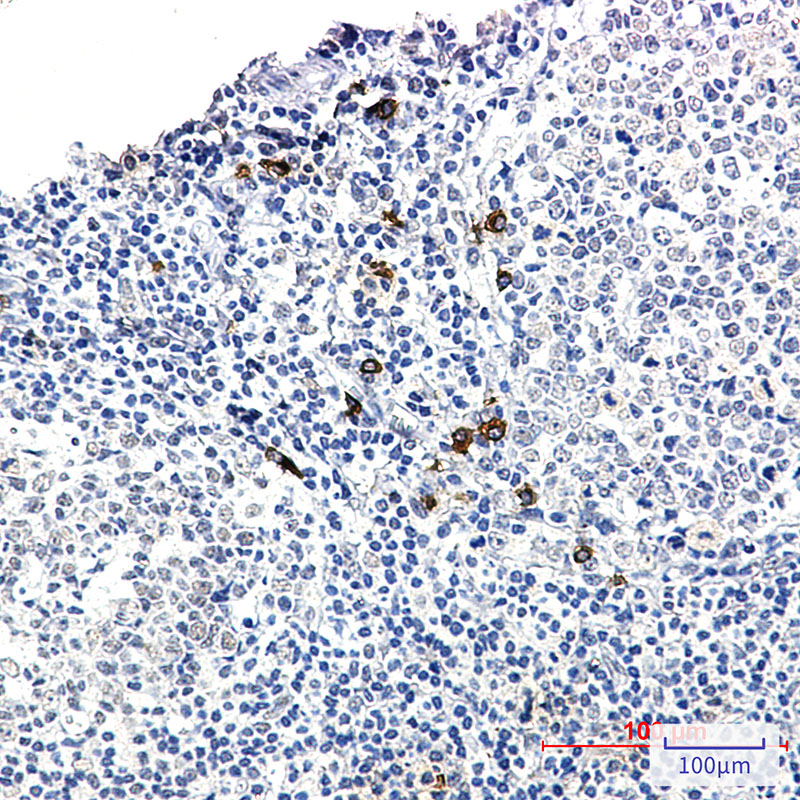 Human IgG4 Rabbit mAb ABZ3391