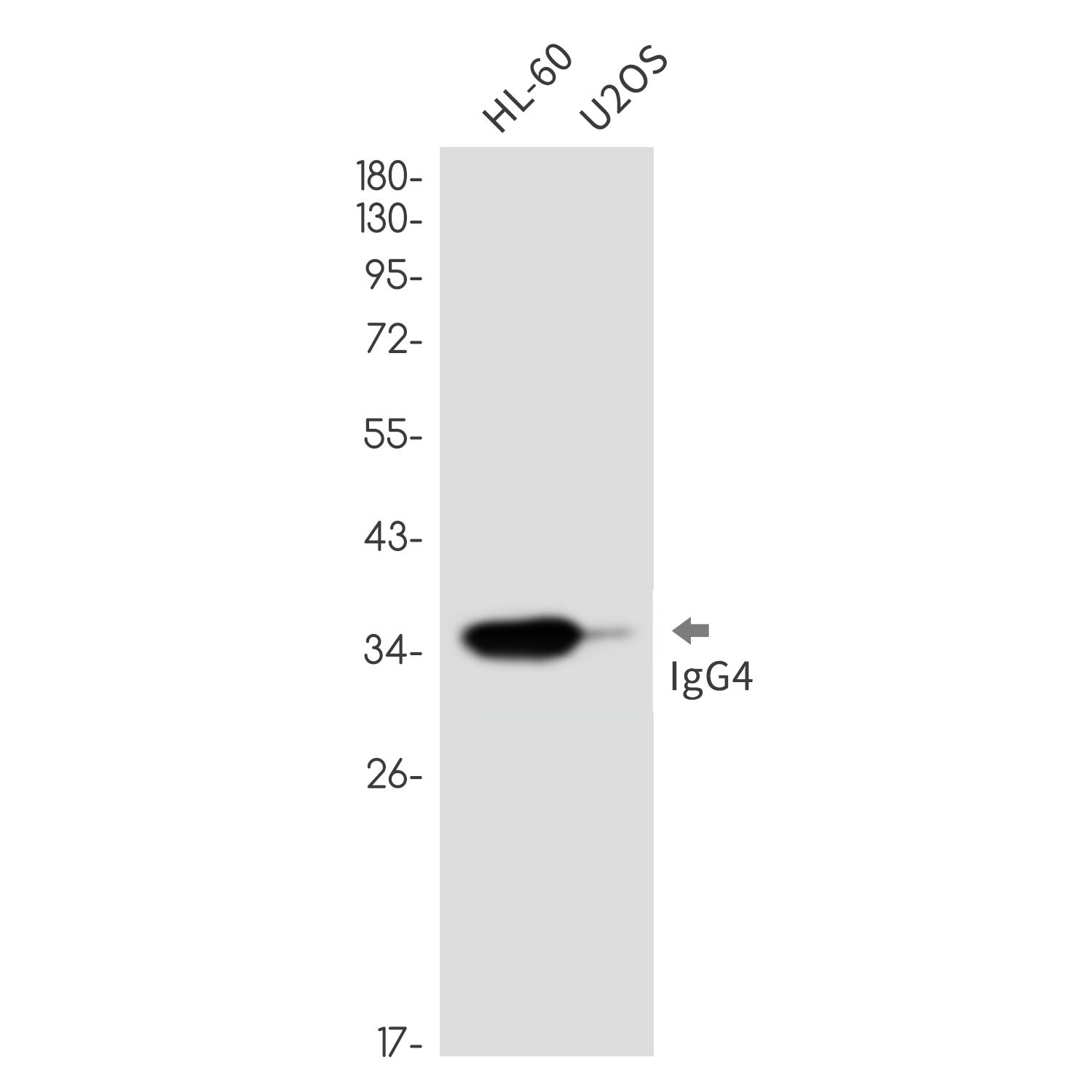 Human IgG4 Rabbit mAb ABZ3391