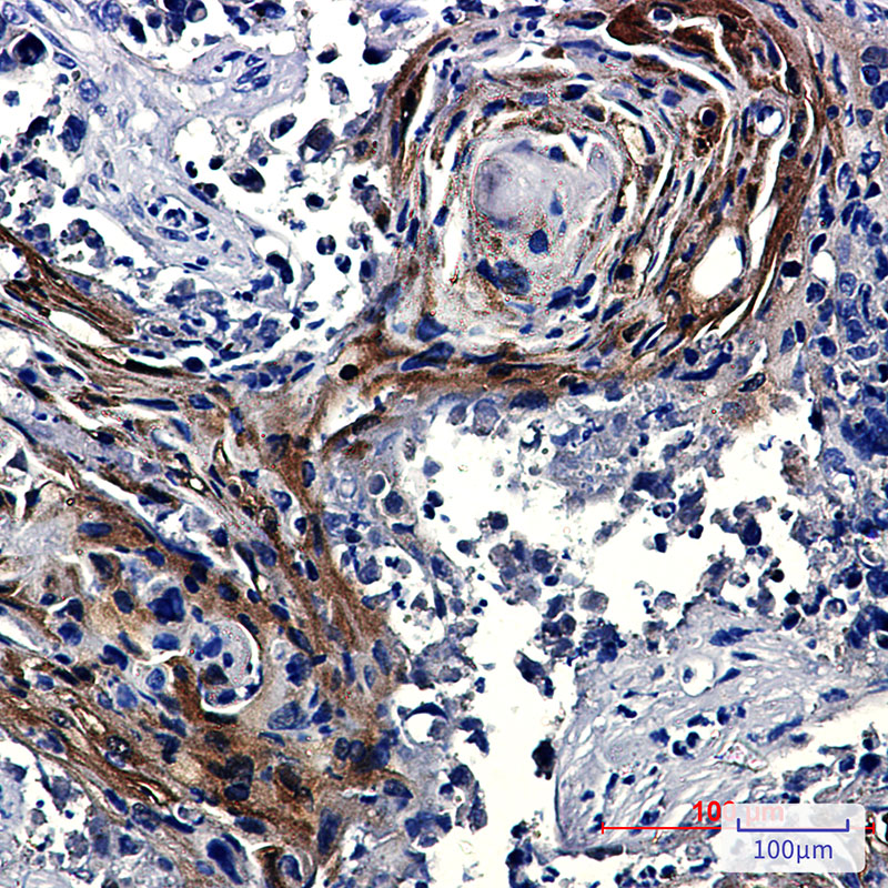 Insulin degrading enzyme Rabbit mAb ABZ3392