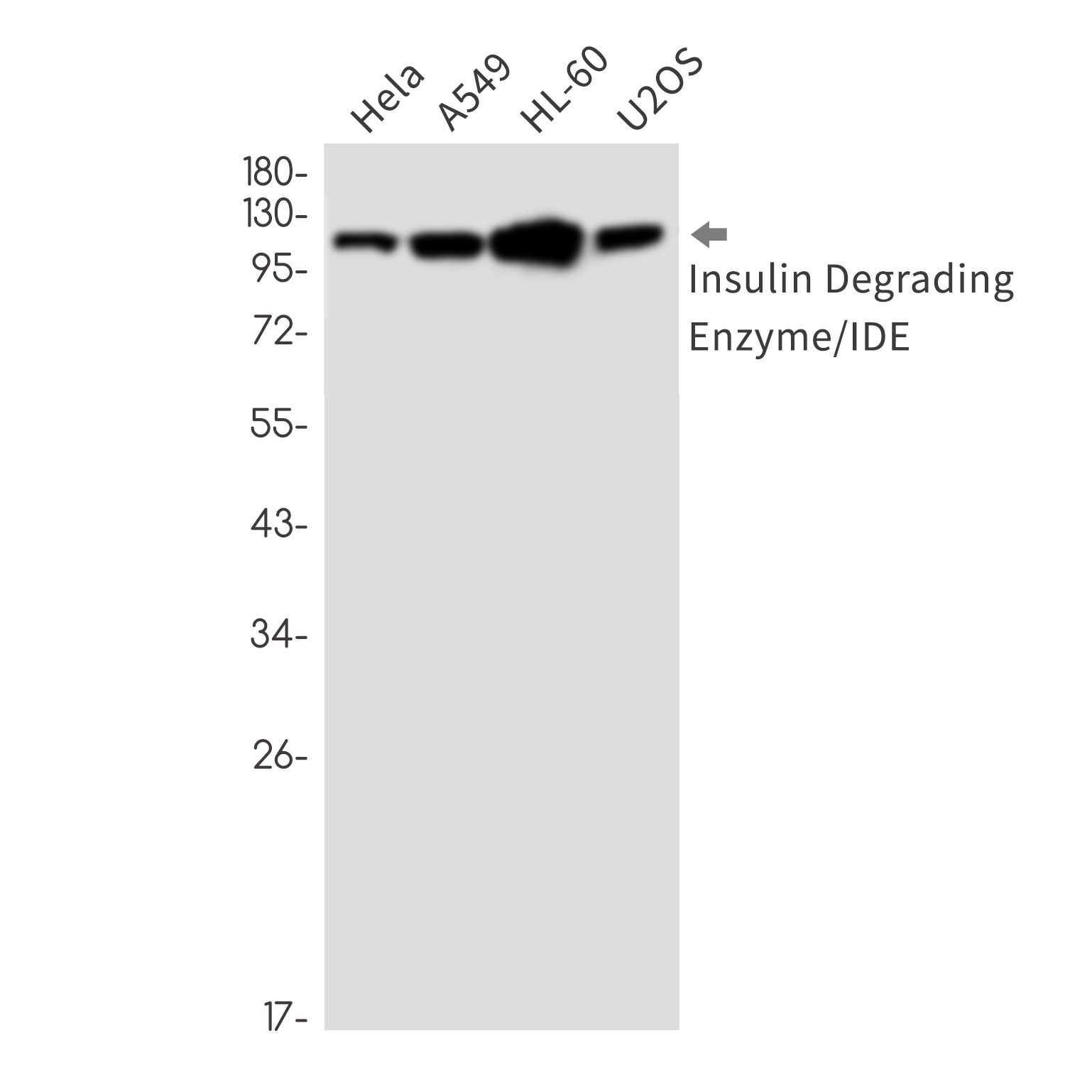 Insulin degrading enzyme Rabbit mAb ABZ3392