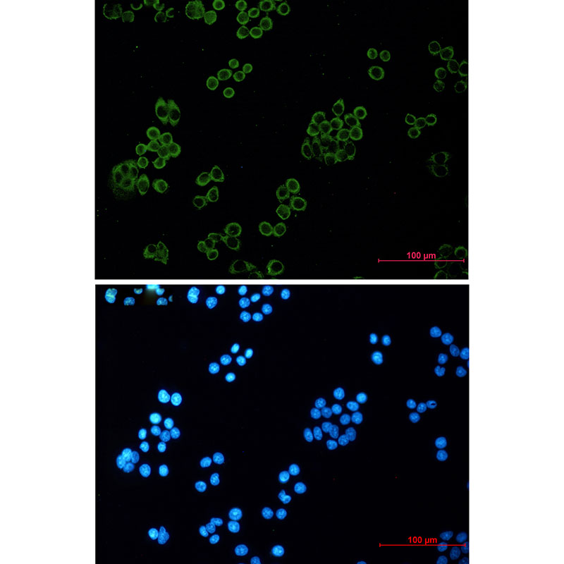 Human kappa Light Chain Rabbit mAb ABZ3394