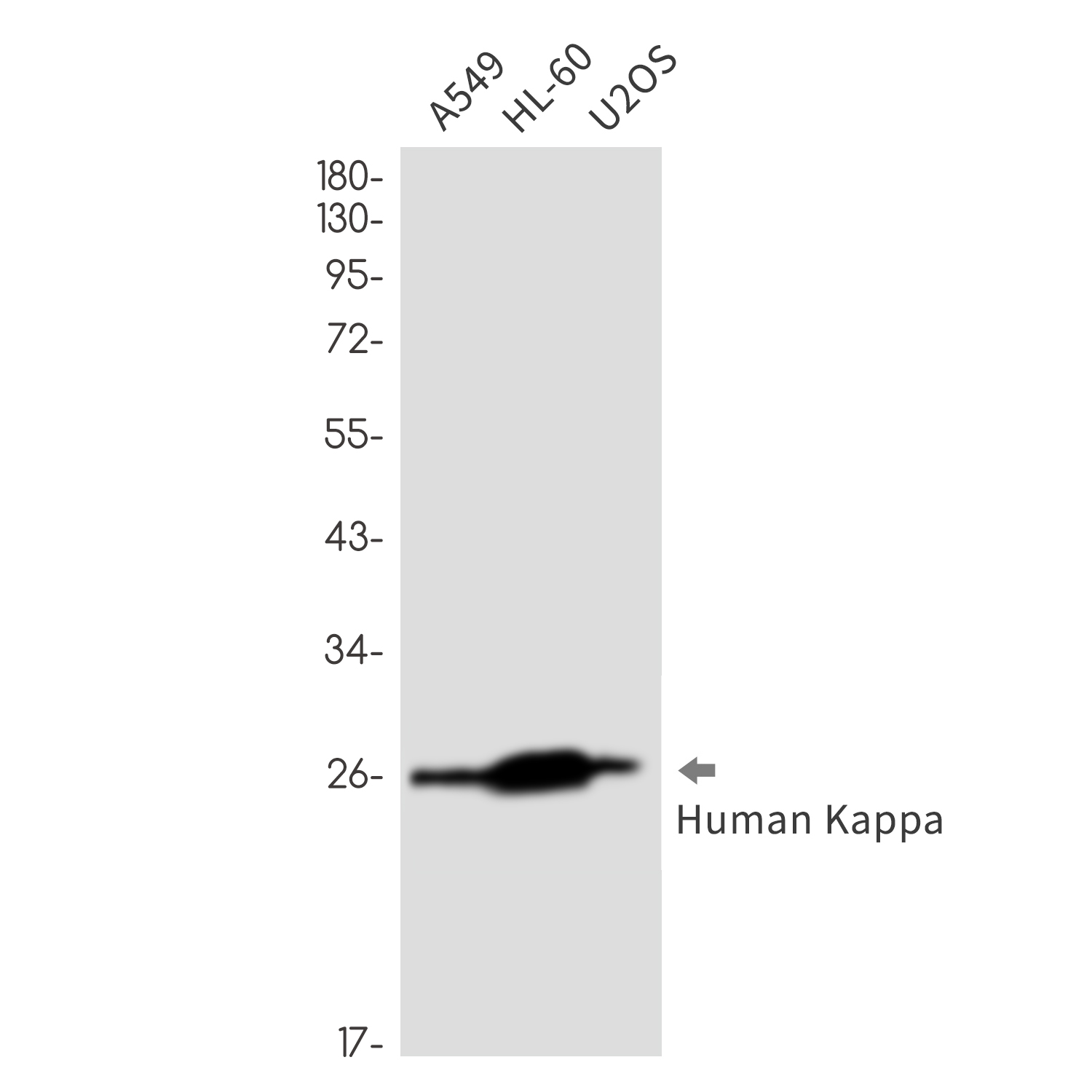 Human kappa Light Chain Rabbit mAb ABZ3394