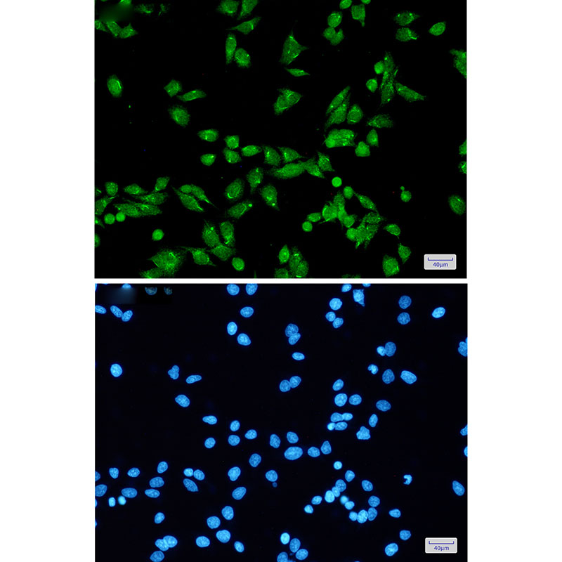 PRPF31 Rabbit mAb ABZ3396