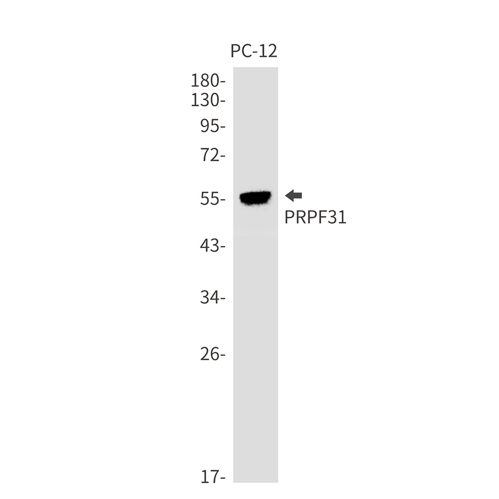 PRPF31 Rabbit mAb ABZ3396