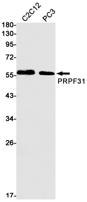 PRPF31 Rabbit mAb ABZ3396
