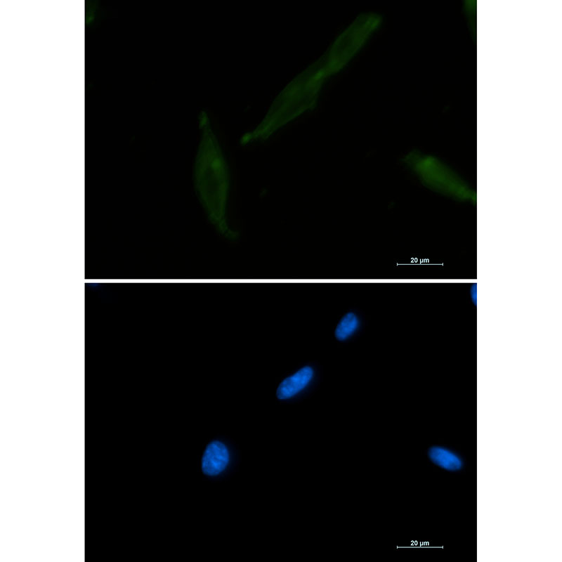 CD147 Rabbit mAb ABZ3397