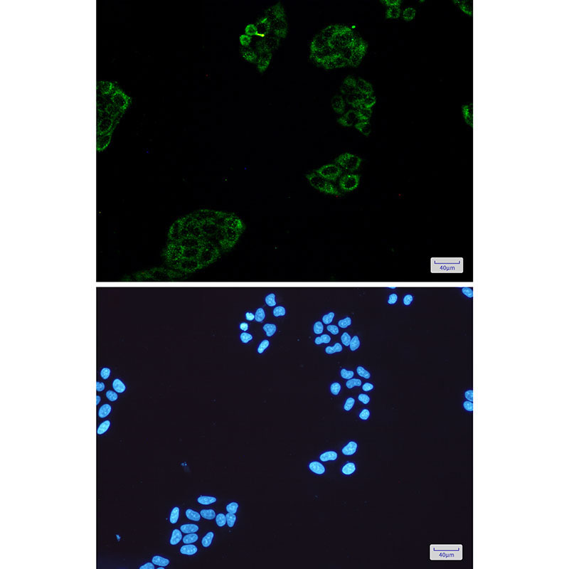 Collagen III alpha 1 Rabbit mAb ABZ3398