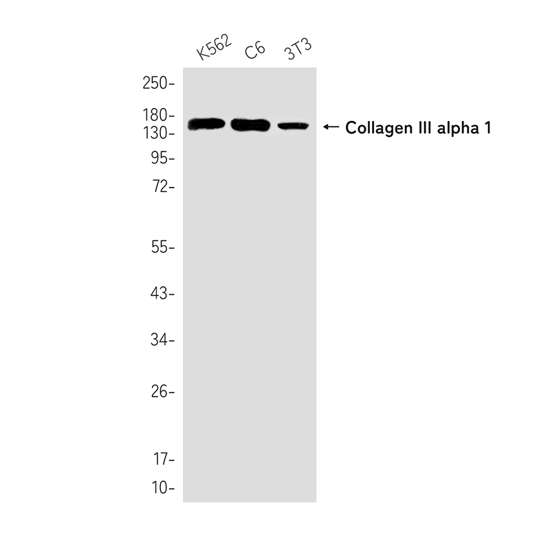 Collagen III alpha 1 Rabbit mAb ABZ3398