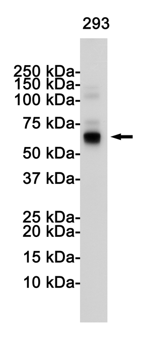 S6K1 Rabbit mAb ABZ3399