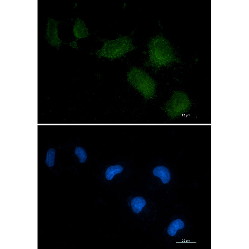 Vitamin D Binding protein Rabbit mAb ABZ3400
