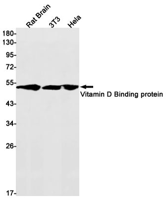 Vitamin D Binding protein Rabbit mAb ABZ3400