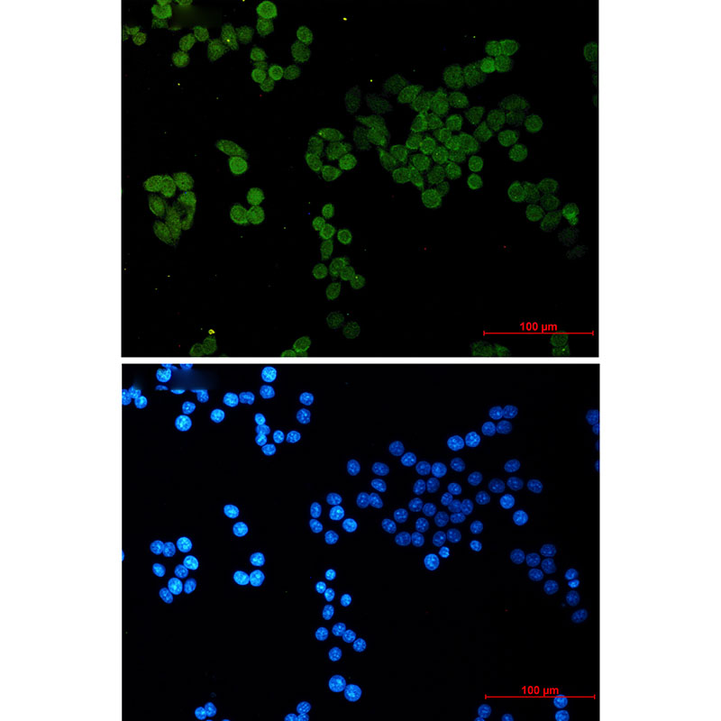 CRCP Rabbit mAb ABZ3401